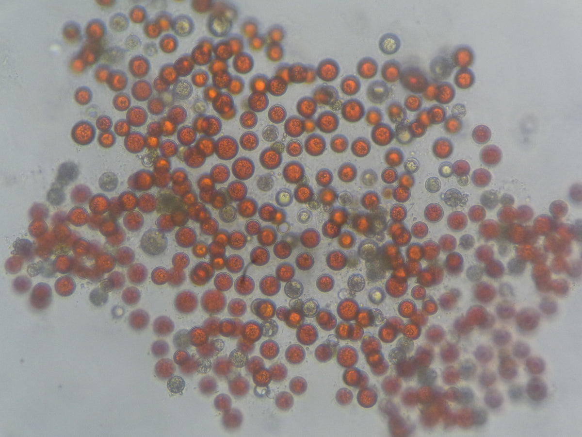 Mikroskopaufnahme der Mikroalge Haematococcus pluvialis mit roten und grünen Zellen